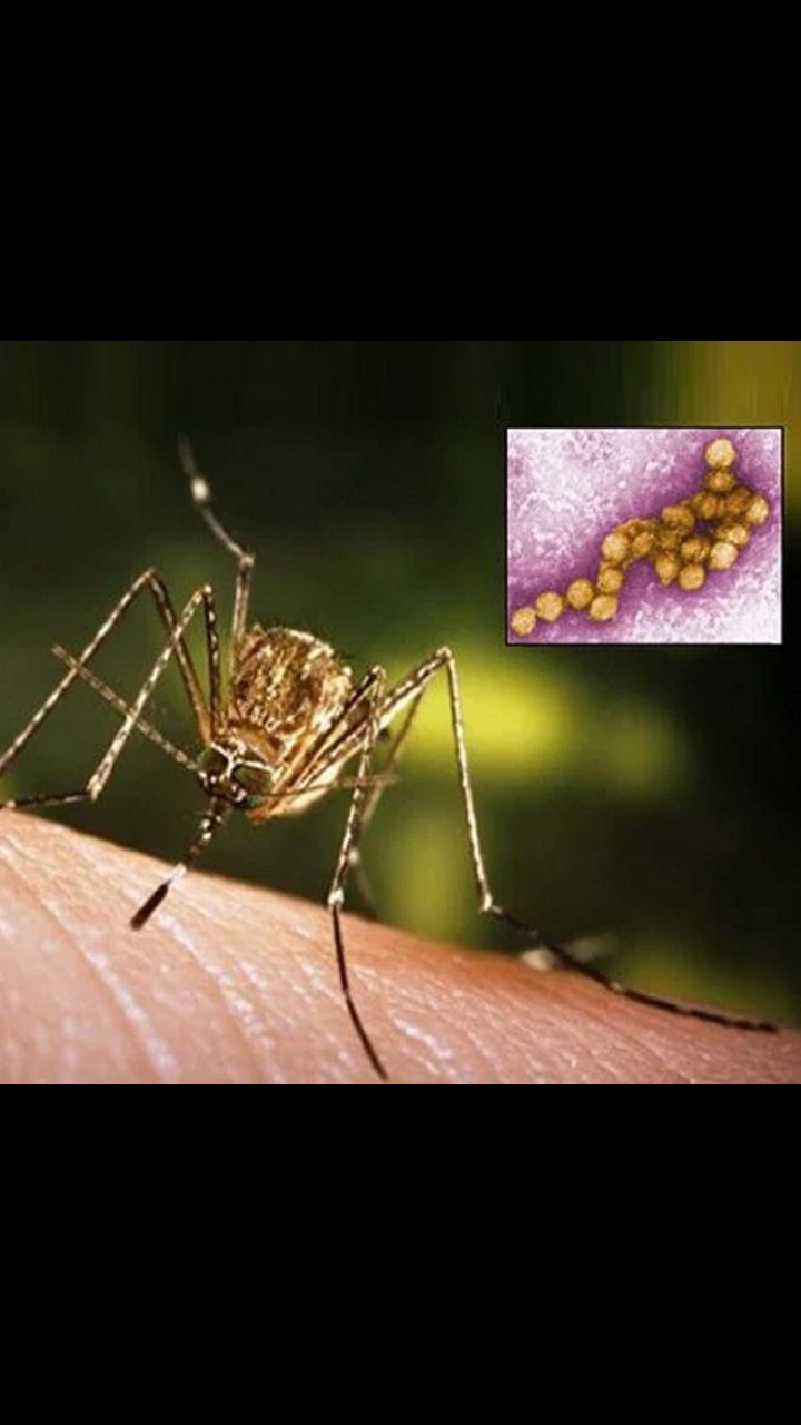 7 West Nile Virus Symptoms: Spot The Signs For Quick Medical Action