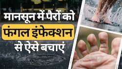 Monsoon में पैरों को Fungal Infection से बचाने के लिए अपनाएं ये टिप्स