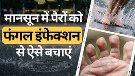 Monsoon में पैरों को Fungal Infection से बचाने के लिए अपनाएं ये टिप्स