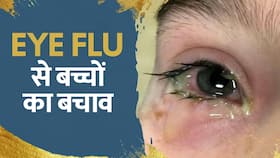 Eye Flu Treatment: बच्चों में बढ़ रहे हैं Eye Flu के मामले, ऐसे करें बचाव Eye Flu Treatment: बच्चों में बढ़ रहे हैं Eye Flu के मामले, ऐसे करें बचाव