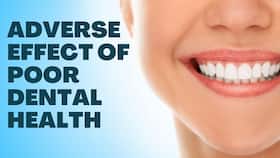 Dental Care For Brain health : The impact of poor dental health on overall well-being Dental Care For Brain health : The impact of poor dental health on overall well-being