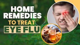 Home Remedies for Eye Flu!