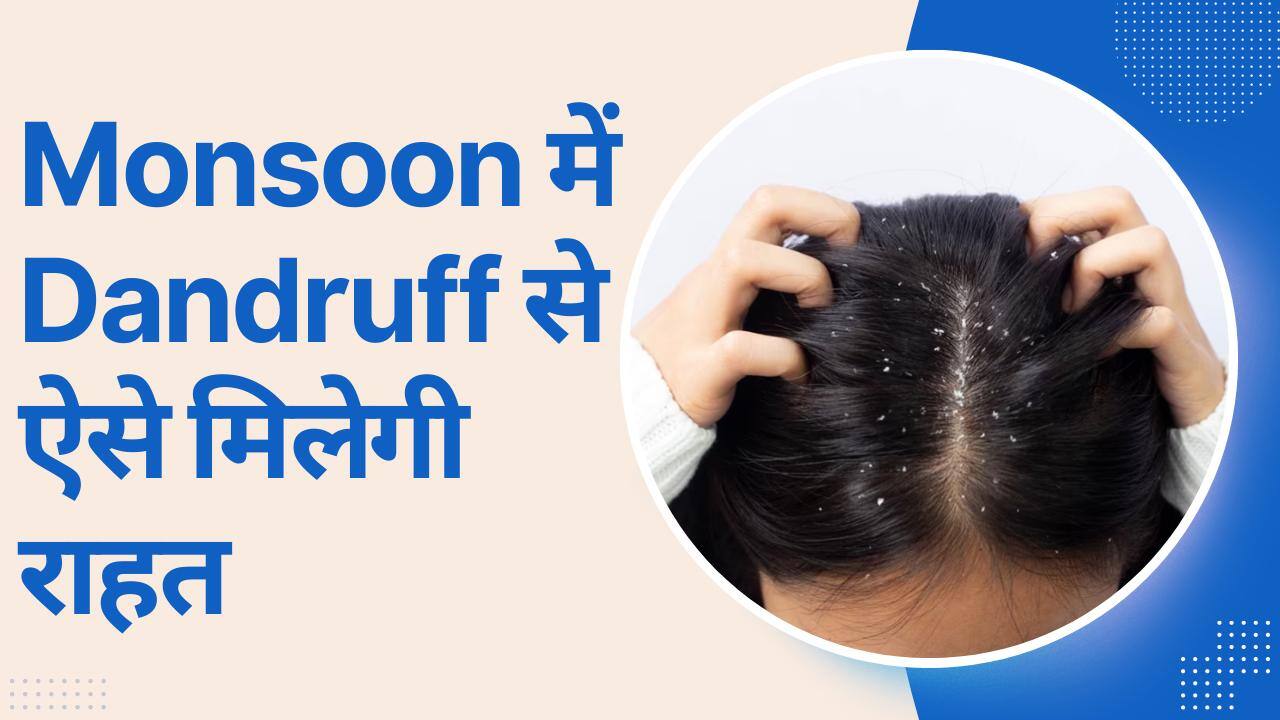 Monsoon Hair Care Tips इन आसान तरीकों से मिलेगी Dandruff से राहत हिंदी