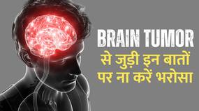 World Brain Day: Brain Tumor से जुड़ें इन Myths के बारे में जानते हैं आप?