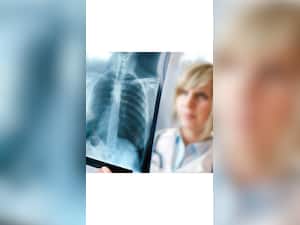 10 Foods To Fight Against Pneumonia