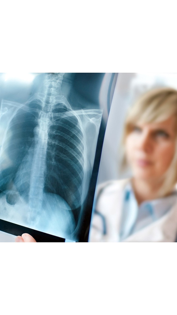 10 Foods To Fight Against Pneumonia