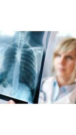 10 Foods To Fight Against Pneumonia