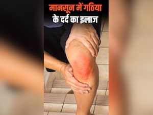 Arthritis pain : बारिश में गठिया के दर्द का ये हैं अचूक उपाय