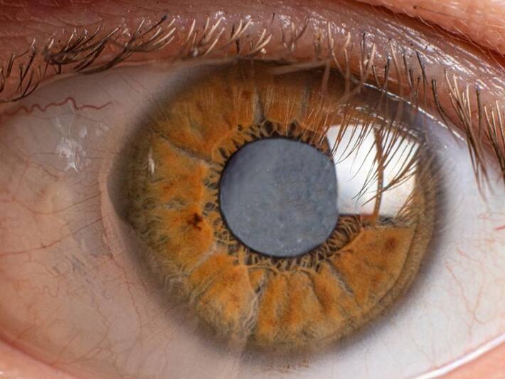 5 Diseases That Can Cause Blindness