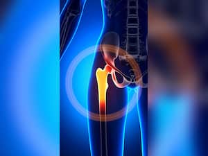 Bone Health: Know 5 Mistakes That Make Your Bone Weak