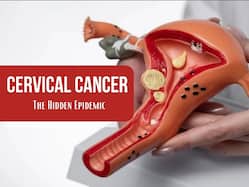 Cervical Health At Every Age: Tailoring Care To Live Stages