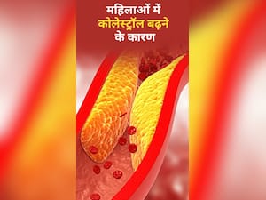 महिलाओं में कोलेस्ट्रॉल के 8 कारण