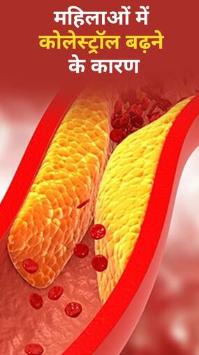 महिलाओं में कोलेस्ट्रॉल के 8 कारण