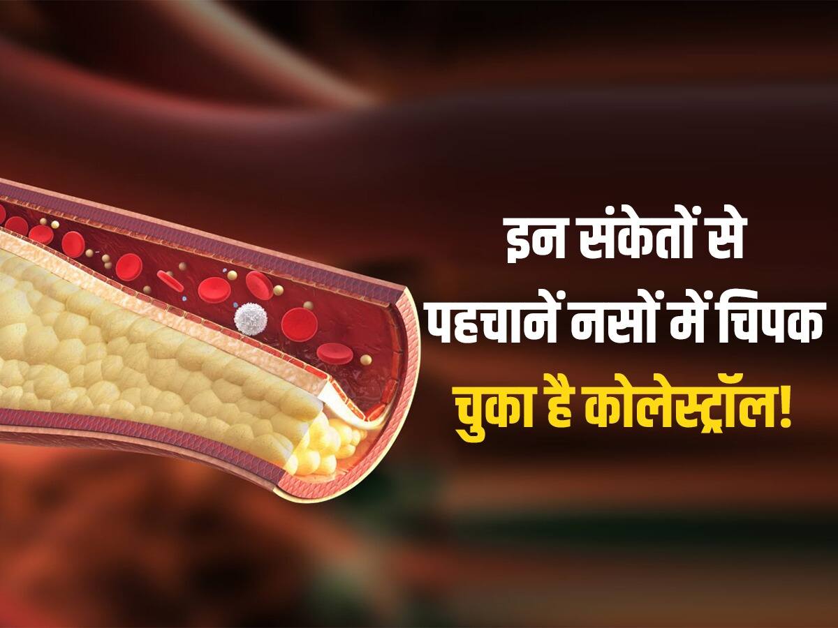 high cholesterol ke lakshan शरीर के इन 2 संकेतों से पहचानें नसों में