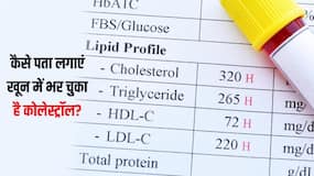किन कारणों से नसों में भर जाता है कोलेस्ट्रॉल? डॉक्टर से जानें कोलेस्ट्रॉल की जांच के लिए जरूरी ब्लड टेस्ट