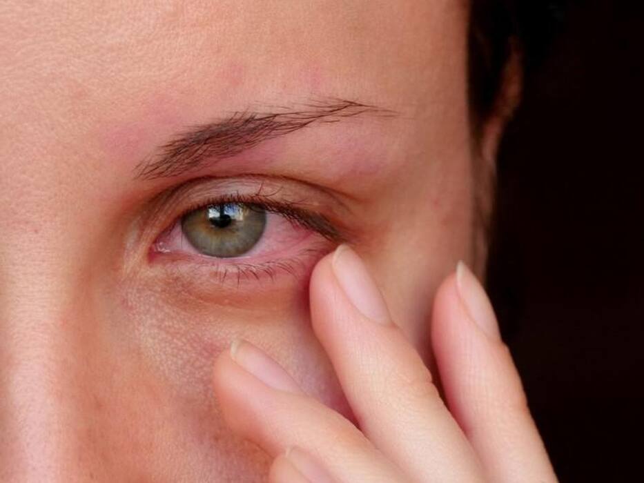 Eye Infection Symptoms: 5 Warning Signs You Should Never Ignore
