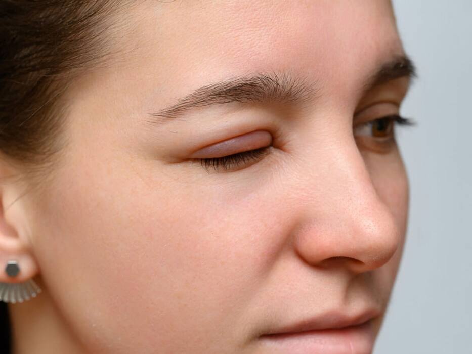 Eye Infection Symptoms: 5 Warning Signs You Should Never Ignore