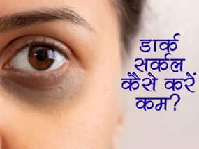 आंखों के आसपास काले घेरे छीन सकती है आपकी खूबसूरती, इन नुस्खों से तुरंत पाएं छुटकारा