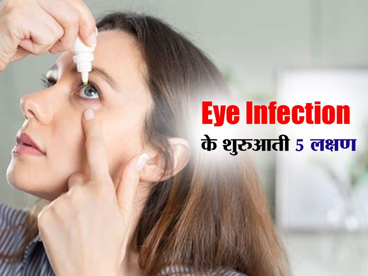 Common eye infection देशभर में तेजी से फैल रहा है आई फ्लू का खतरा, इन