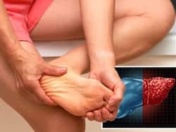 Fatty Liver Disease Symptoms: Unusual Swelling In These 5 Body Parts Could Be A Sign of Liver Disease