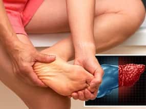 Fatty Liver Disease Symptoms: Unusual Swelling In These 5 Body Parts Could Be A Sign of Liver Disease Fatty Liver Disease Symptoms: Unusual Swelling In These 5 Body Parts Could Be A Sign of Liver Disease