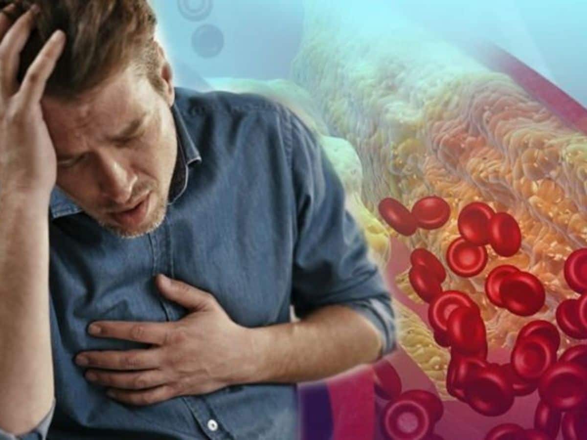 Bad Cholesterol Levels Above 200: Here’s What High Cholesterol Can Do Inside Your Body