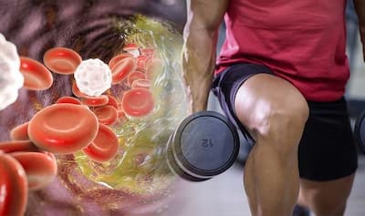 High Cholesterol Lowering Exercises: 5 Workouts To Get Rid of Bad Cholesterol Levels