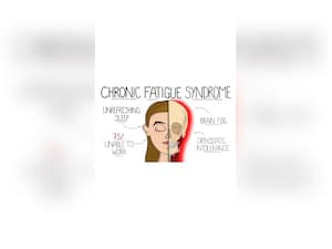 Chronic Fatigue Syndrome: Top 10 Symptoms Of CFS Disease