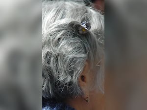 Reduce Premature Greying Of Hair With 10 Foods