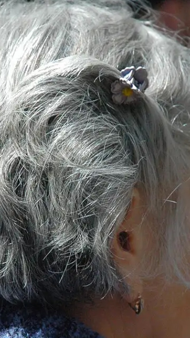 Reduce Premature Greying Of Hair With 10 Foods