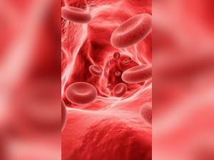 Iron Deficiency Anemia: 10 Tips For Women To Fight This Condition Easily