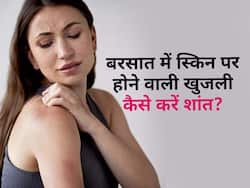 मानसून में स्किन को खुजला-खुजलाकर हो रहे हैं परेशान? इन 5 घरेलू उपायों से करें इसका इलाज