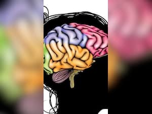 Neurological Disorder: Causes, Symptoms, Treatment