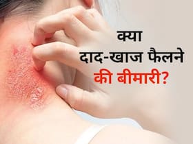  क्या दाद एक व्यक्ति से दूसरे व्यक्ति में फैल सकता है? जानिए किस तरह करें इससे बचाव