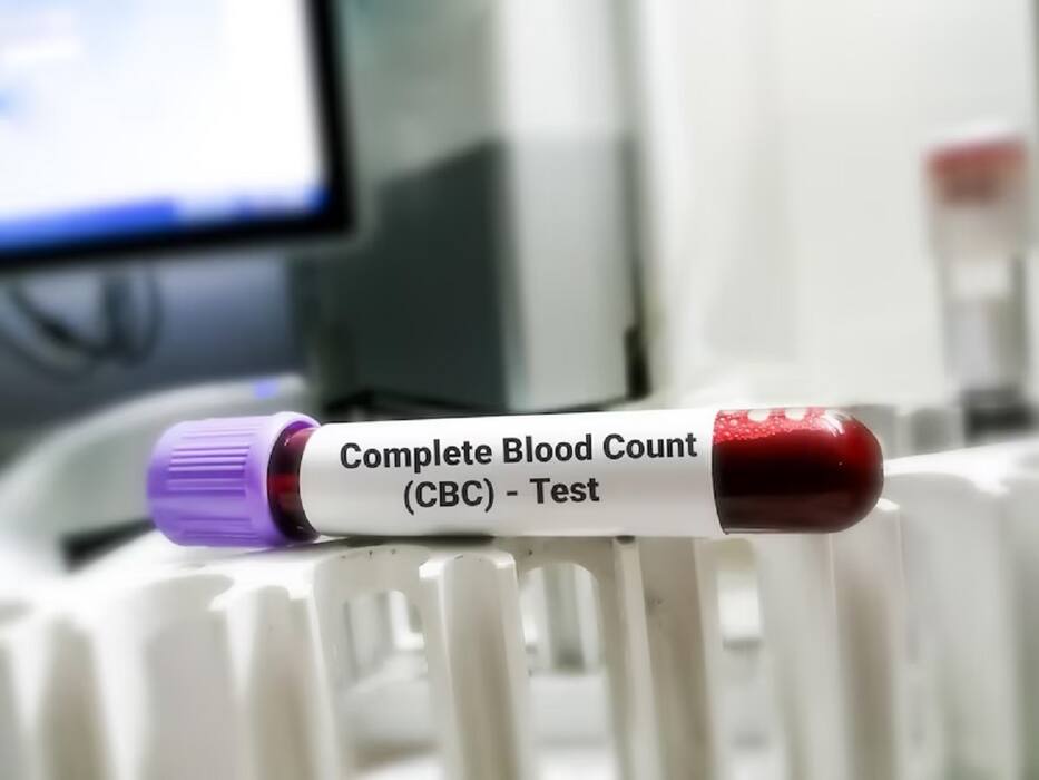 Dengue Fever And Pregnancy Outcomes: 5 Side-Effects On Pregnant Woman And Baby