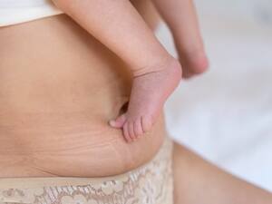 When will my postpartum belly go away? - Today's Parent
