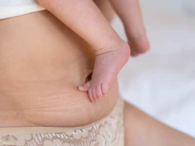 Postpartum Body Changes: Is Your Mummy Tummy Diastasis Recti?