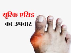 जोड़ों में जमा यूरिक एसिड को साफ कर देते हैं ये 5 घरेलू नुस्खे, दर्द से जल्द मिलता है आराम