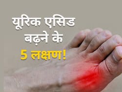 शरीर में यूरिक एसिड बढ़ने पर दिखने लगते हैं ये 5 बदलाव, भूलकर भी न करें नजरअंदाज