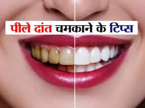 पीले-पीले दांतों की वजह से नहीं कर पाते हैं खुलकर स्माइल, इन नुस्खों से चमकाएं अपनी दांत
