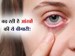 छोटे बच्चों में बढ़ रहा आंखों का संक्रमण, स्कूल प्रशासन सतर्क, एक्सपर्ट से जानिए लक्षण और बचाव