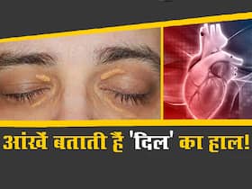 हार्ट अटैक आने से पहले आंखों में दिखते हैं ये 4 लक्षण! जानिए दिल के बारे में क्या कहती हैं आपकी आंखें