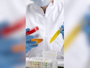 Foul Smell In Urine? 7 Things That May Be Causing It