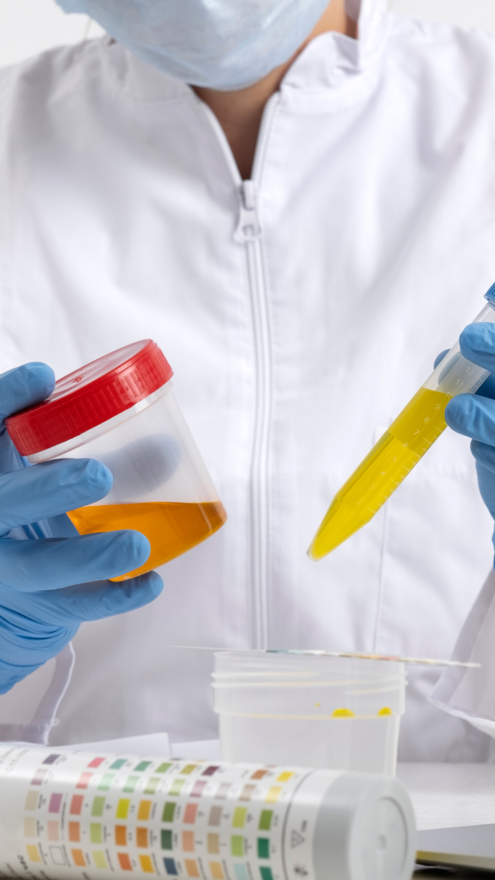 Foul Smell In Urine? 7 Things That May Be Causing It