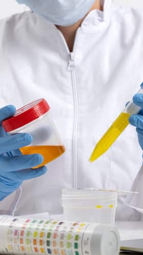 Foul Smell In Urine? 7 Things That May Be Causing It Foul Smell In Urine? 7 Things That May Be Causing It