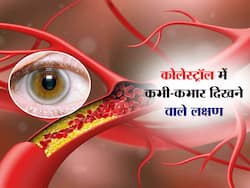 Bad Cholesterol बढ़ने से कभी-कभार होने वाले ये 6 लक्षण, इग्नोर किया तो नहीं कंट्रोल कर पाएंगे कोलेस्ट्रॉल