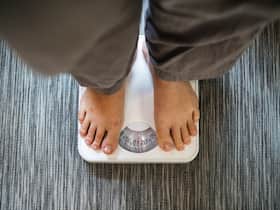 Obese With Normal Weight: Body Fat Percentage Is The Actual Measure For Obesity! Obese With Normal Weight: Body Fat Percentage Is The Actual Measure For Obesity!