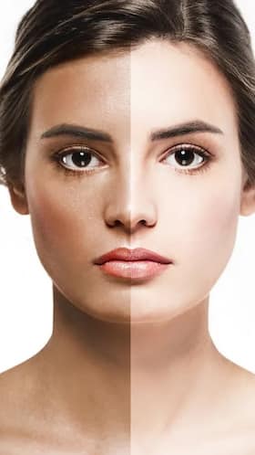How To Get Rid Of Tan Naturally - 10 Tips