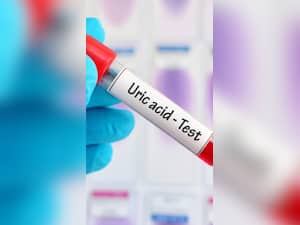 High Uric Acid Management: 10 Home Remedies To Keep The Condition Under Control