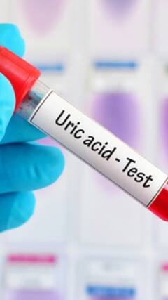 High Uric Acid Management: 10 Home Remedies To Keep The Condition Under Control